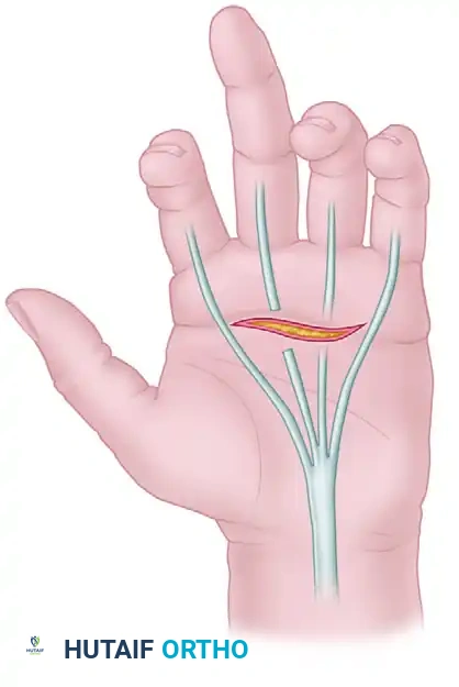 EXAMINATION Surgical Diagram