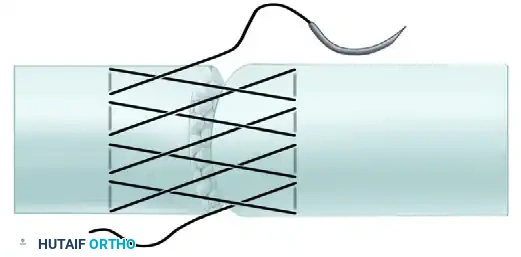 Hutaifortho's Orthopaedic Diagram