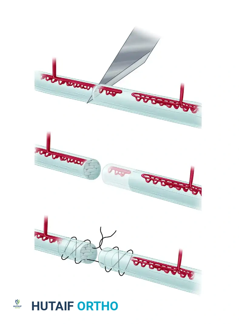 Hutaifortho's Orthopaedic Diagram