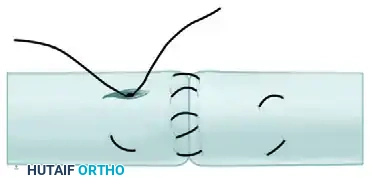 Hutaifortho's Orthopaedic Diagram