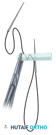 Advanced Suture Configuration