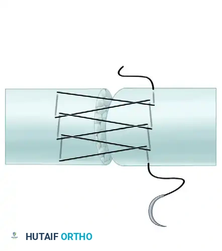 Hutaifortho's Orthopaedic Diagram