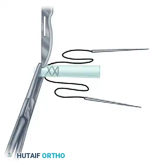 Hutaifortho's Orthopaedic Diagram