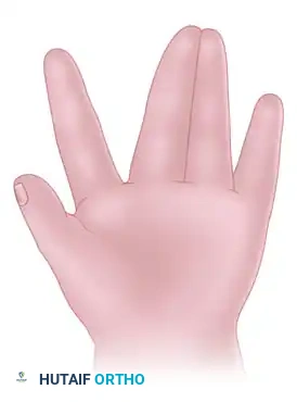 Hutaifortho's Orthopaedic Diagram