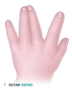 Hutaifortho's Orthopaedic Diagram