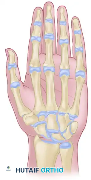 المنطقة التشريحية الأولى المفصل بين السلاميات القاصي