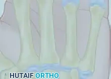 المنطقة التشريحية السادسة عظام المشط