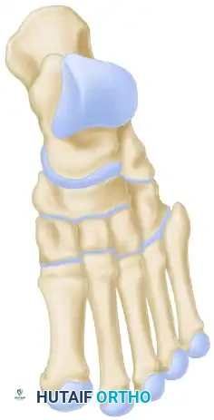 Jahss Incisions and Exposure