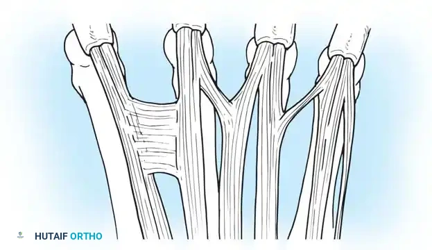 Comprehensive Management of Extensor Tendon Injuries: Anatomy, Biomechanics, and Surgical Techniques