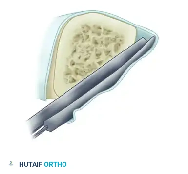 Hutaifortho's Orthopaedic Diagram