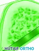 Hutaifortho's Orthopaedic Diagram