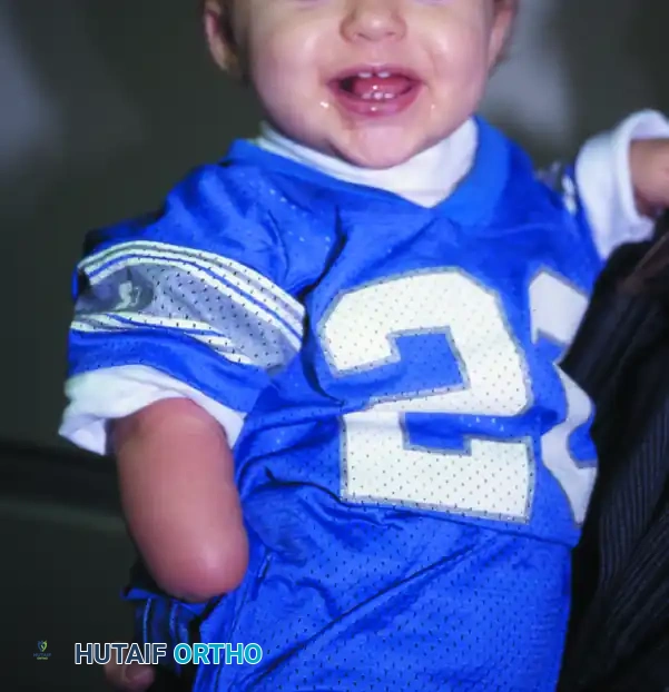 FAILURE OF FORMATION (ARREST OF DEVELOPMENT) Surgical Diagram