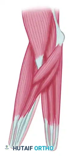 FAILURE OF FORMATION (ARREST OF DEVELOPMENT) Surgical Diagram