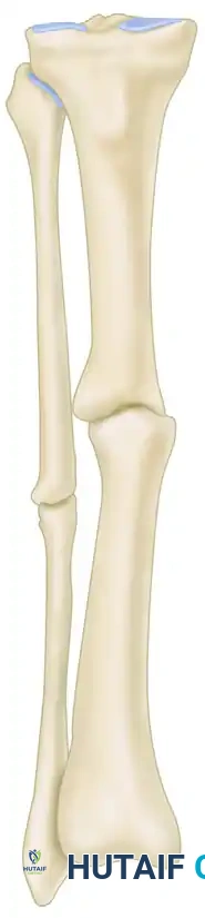 Comprehensive Management of Lower Extremity Nonunions: Fibula, Patella, and Femur