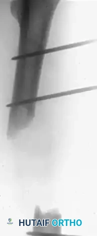 Hutaifortho's Orthopaedic Diagram