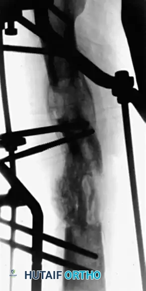 Hutaifortho's Orthopaedic Diagram