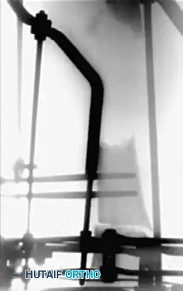 Hutaifortho's Orthopaedic Diagram