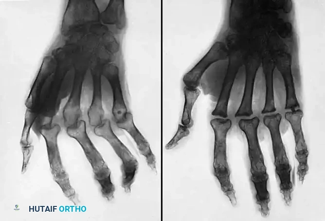 Hutaifortho's Orthopaedic Diagram