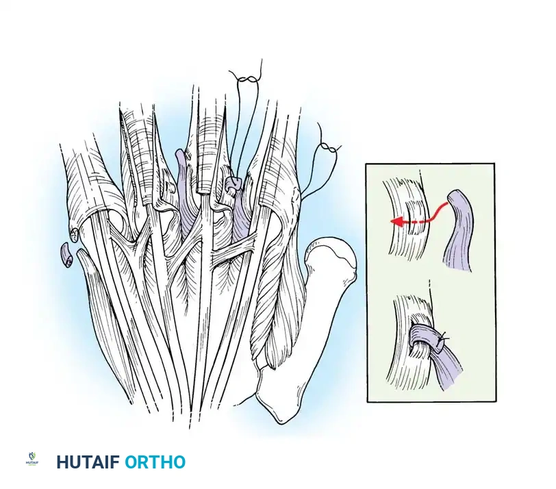 Hutaifortho's Orthopaedic Diagram