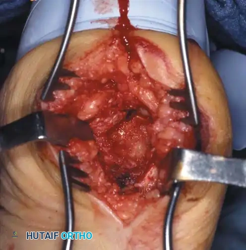 Hutaifortho's Orthopaedic Diagram