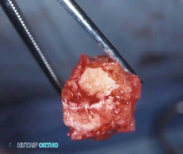 Hutaifortho's Orthopaedic Diagram