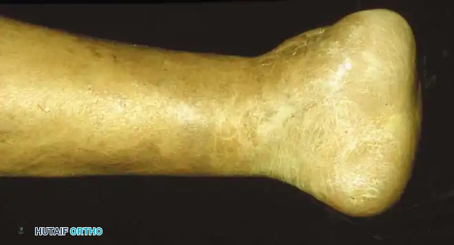 Hutaifortho's Orthopaedic Diagram