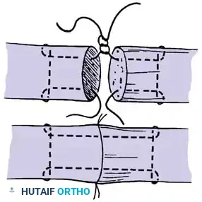 Hutaifortho's Orthopaedic Diagram