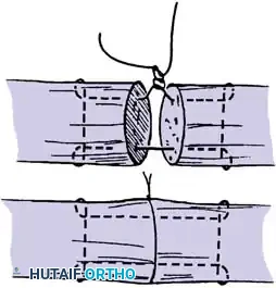 Hutaifortho's Orthopaedic Diagram