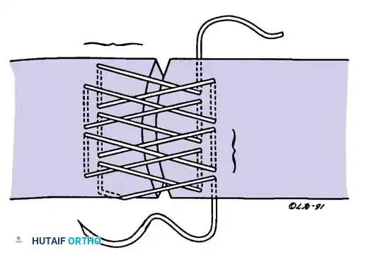 Hutaifortho's Orthopaedic Diagram