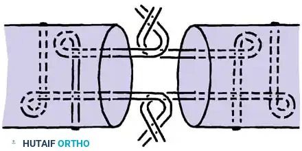 Hutaifortho's Orthopaedic Diagram