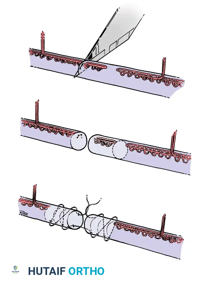 Hutaifortho's Orthopaedic Diagram