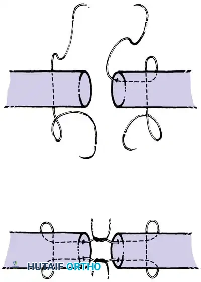 Hutaifortho's Orthopaedic Diagram