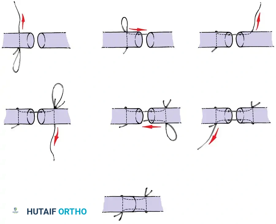 Hutaifortho's Orthopaedic Diagram