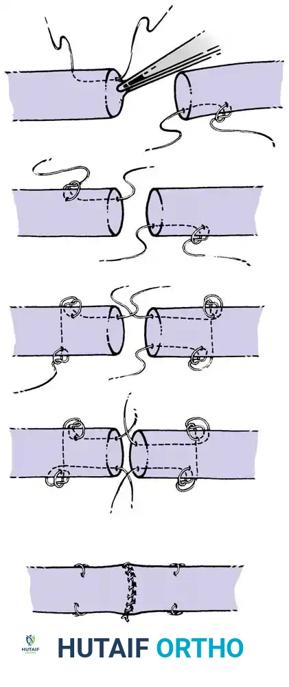 Hutaifortho's Orthopaedic Diagram