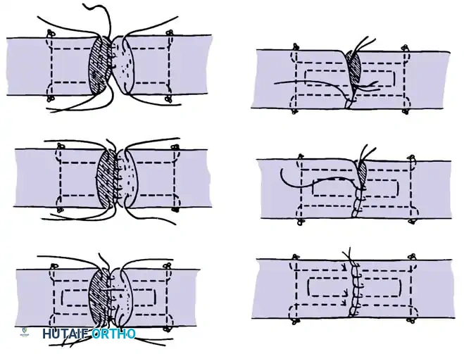 Hutaifortho's Orthopaedic Diagram
