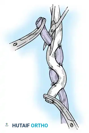 Hutaifortho's Orthopaedic Diagram