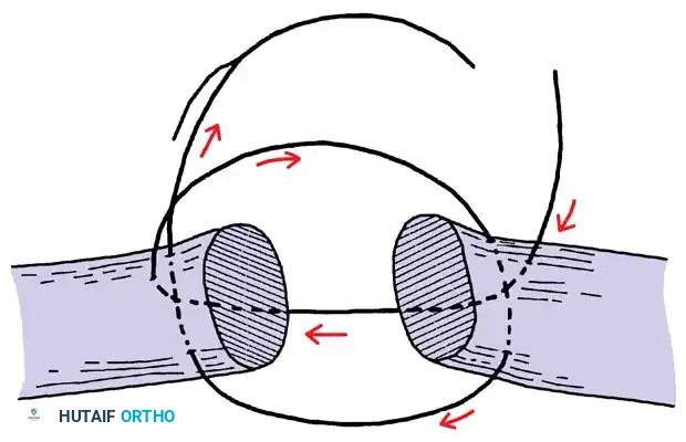 Hutaifortho's Orthopaedic Diagram