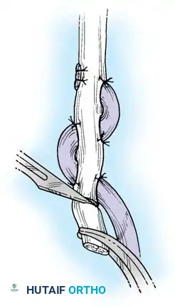 Hutaifortho's Orthopaedic Diagram