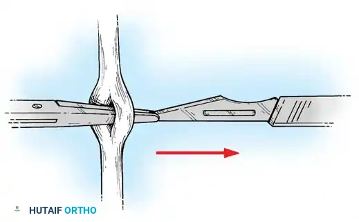 Hutaifortho's Orthopaedic Diagram