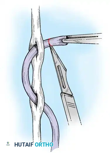 Hutaifortho's Orthopaedic Diagram