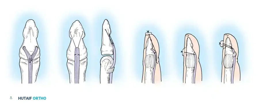 Hutaifortho's Orthopaedic Diagram