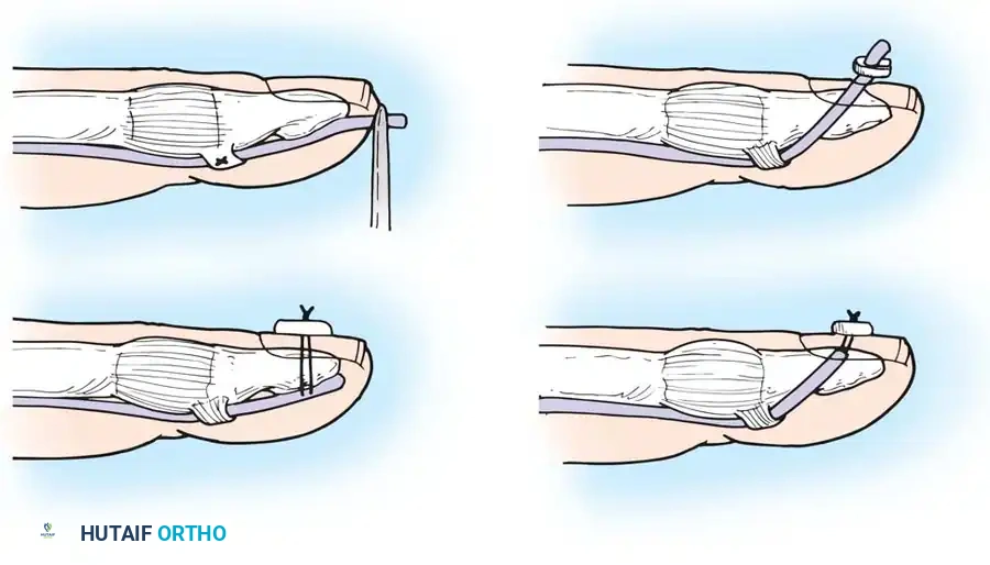 Hutaifortho's Orthopaedic Diagram