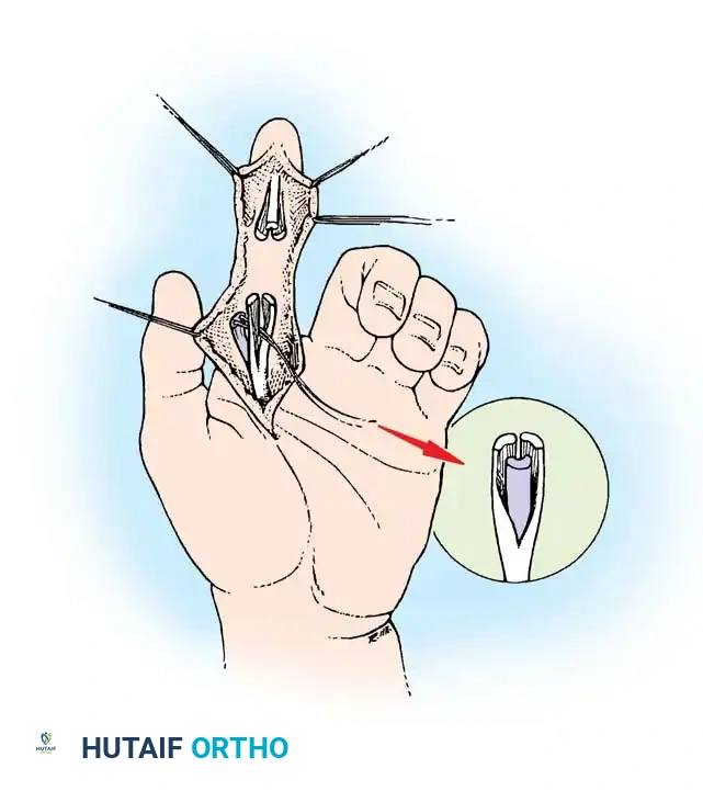 Hutaifortho's Orthopaedic Diagram