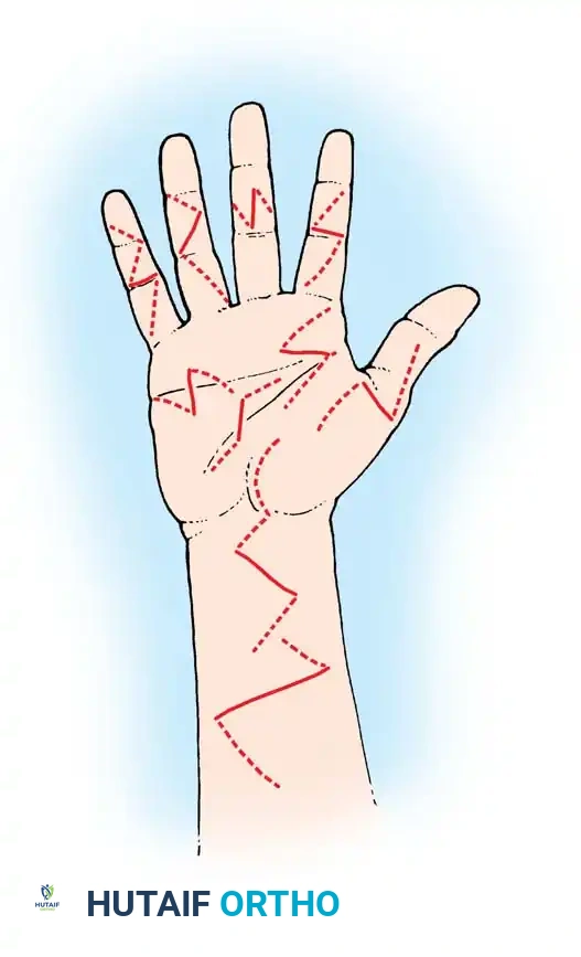 Hutaifortho's Orthopaedic Diagram