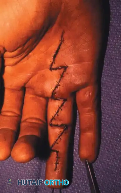 Hutaifortho's Orthopaedic Diagram