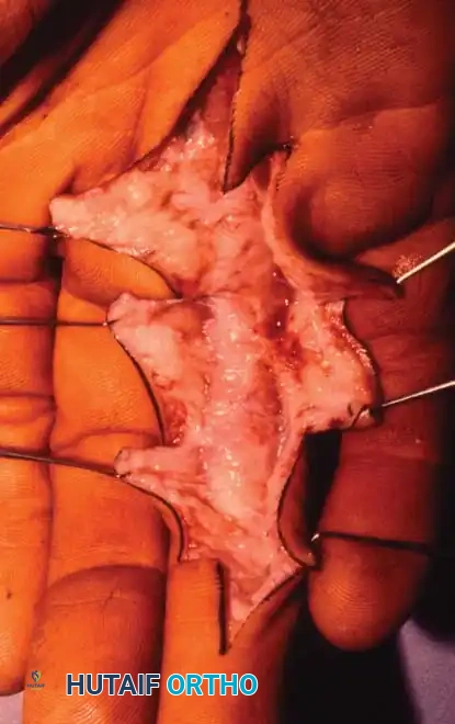 Hutaifortho's Orthopaedic Diagram