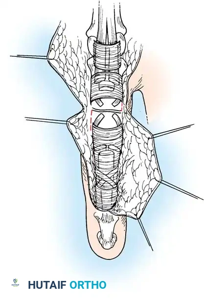 Hutaifortho's Orthopaedic Diagram