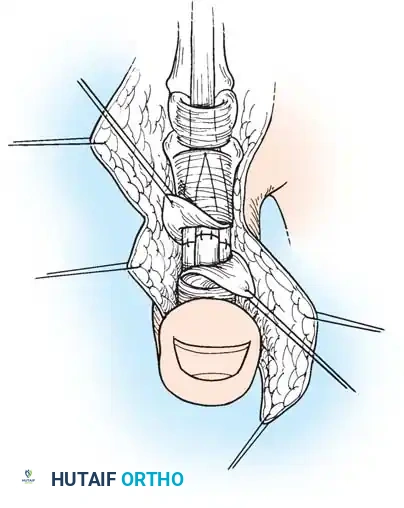 Hutaifortho's Orthopaedic Diagram
