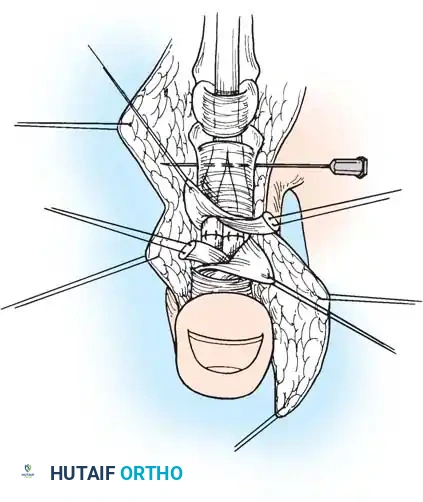 Hutaifortho's Orthopaedic Diagram