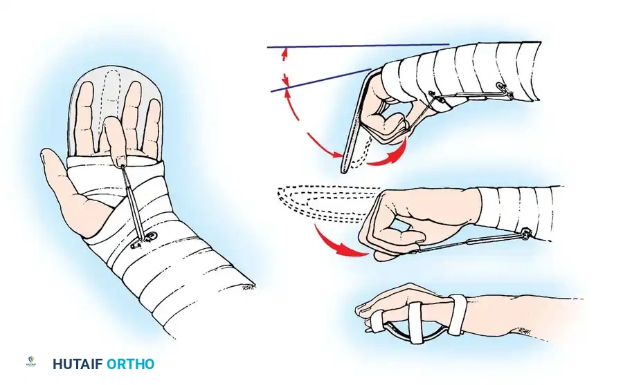 Hutaifortho's Orthopaedic Diagram